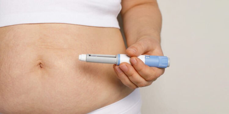 Más allá del cuerpo: el desajuste psicológico tras la rápida pérdida de peso